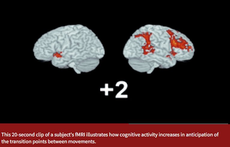 How Music Triggers Brain Activity